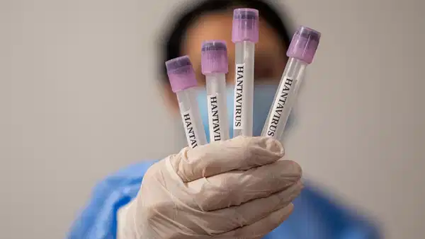 profesorden-dikkat-ceken-hantavirus-aciklamasi-yeniden-bir-pandemi-ihtimali-yok-ama-tedbir-sart-GOb5IcN5-1